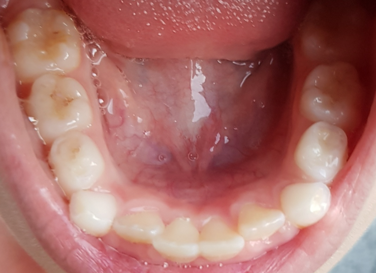 2018 год- коренные зубы